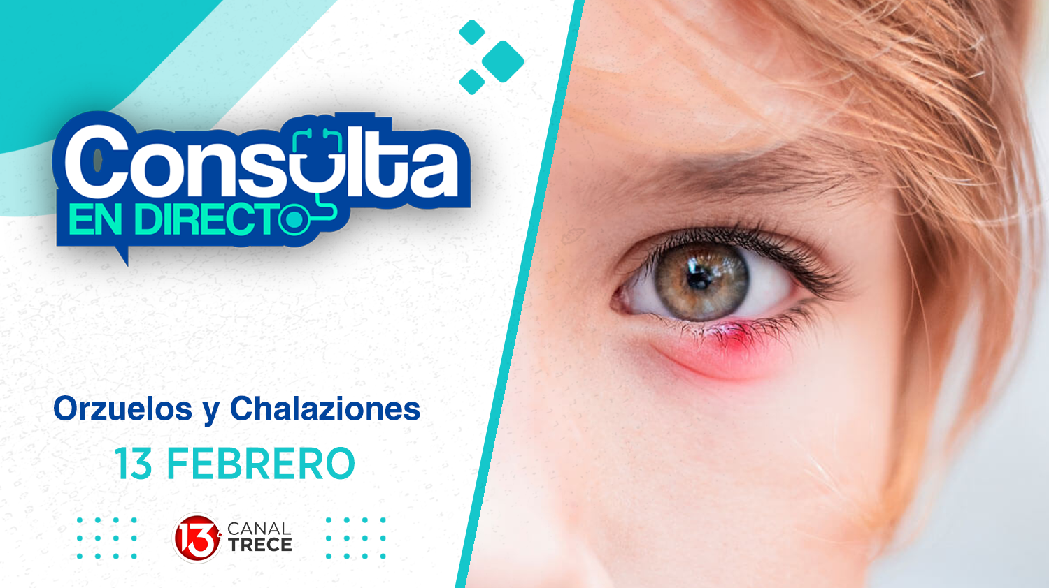 Orzuelo - Consulta en Directo | 13 Febrero 2025