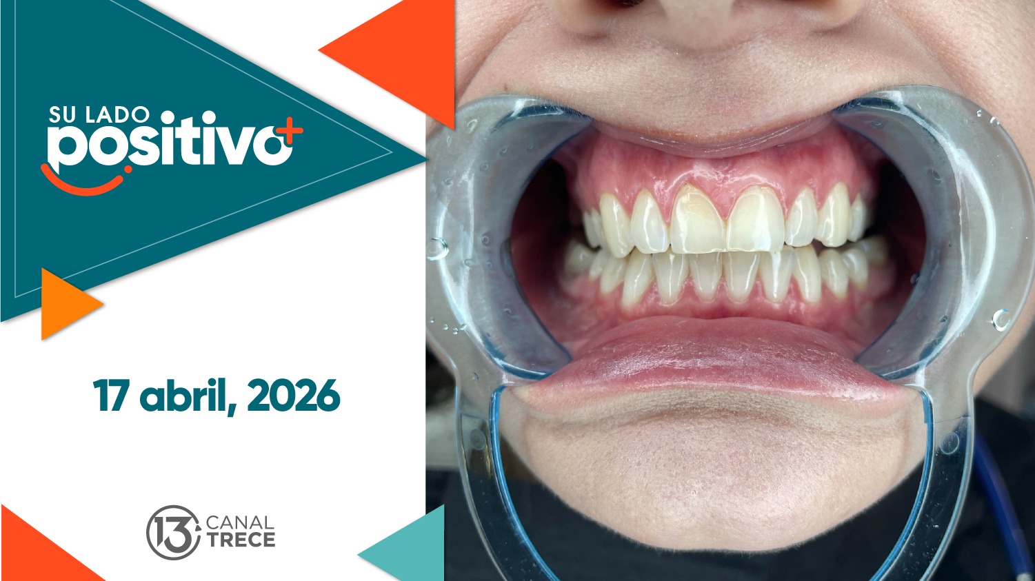 Su Lado Positivo | 17 abril 2026