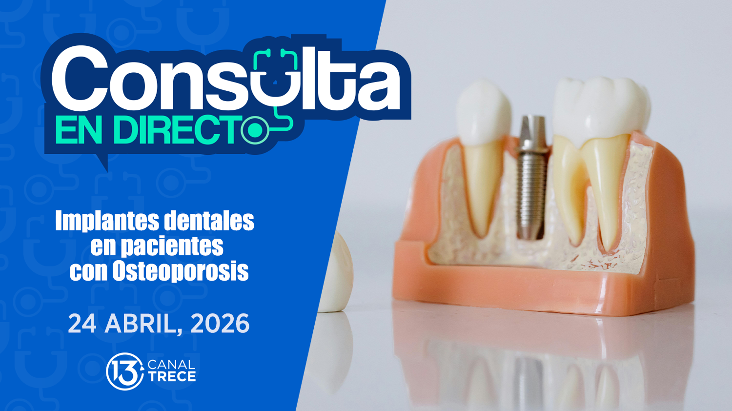 Consulta en Directo | 24 abril 2026