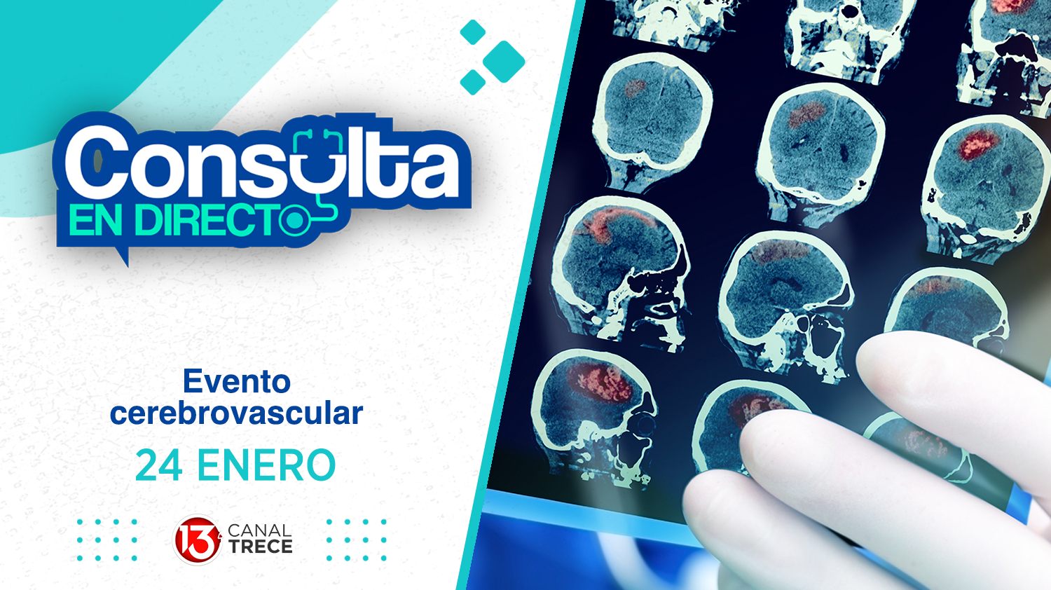 Evento cerebrovascular - Consulta en Directo | 24 Enero 2025