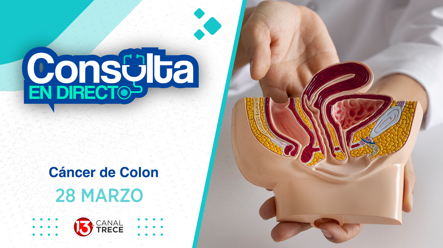  Consulta en Directo | 28 Marzo 2025