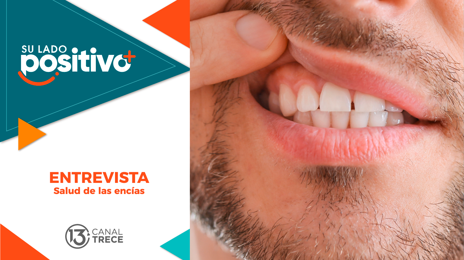 Entrevista Salud de las encías | Su lado Positivo