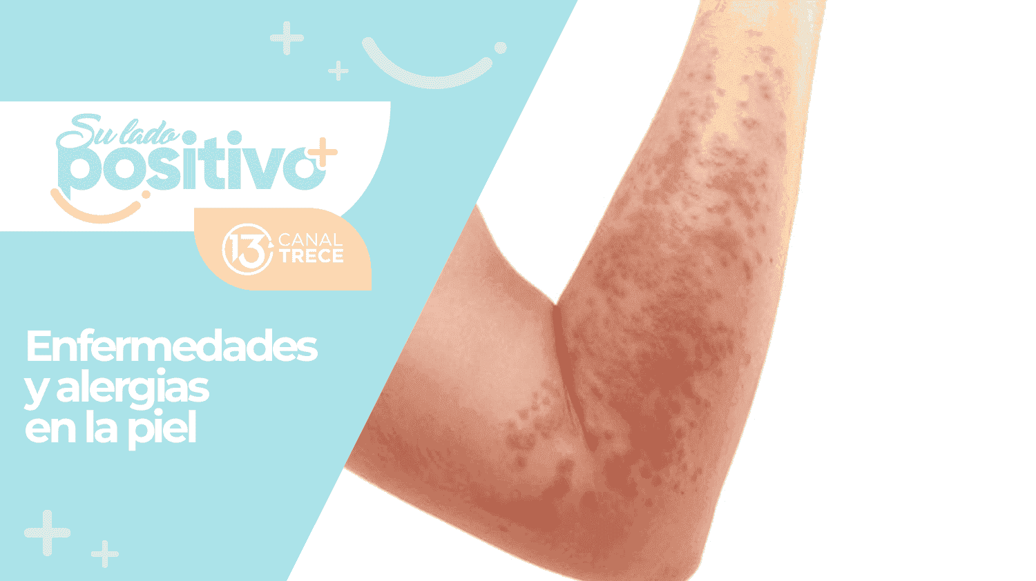 Enfermedades y alergias en la piel ¿Qué las puede ocasionar?