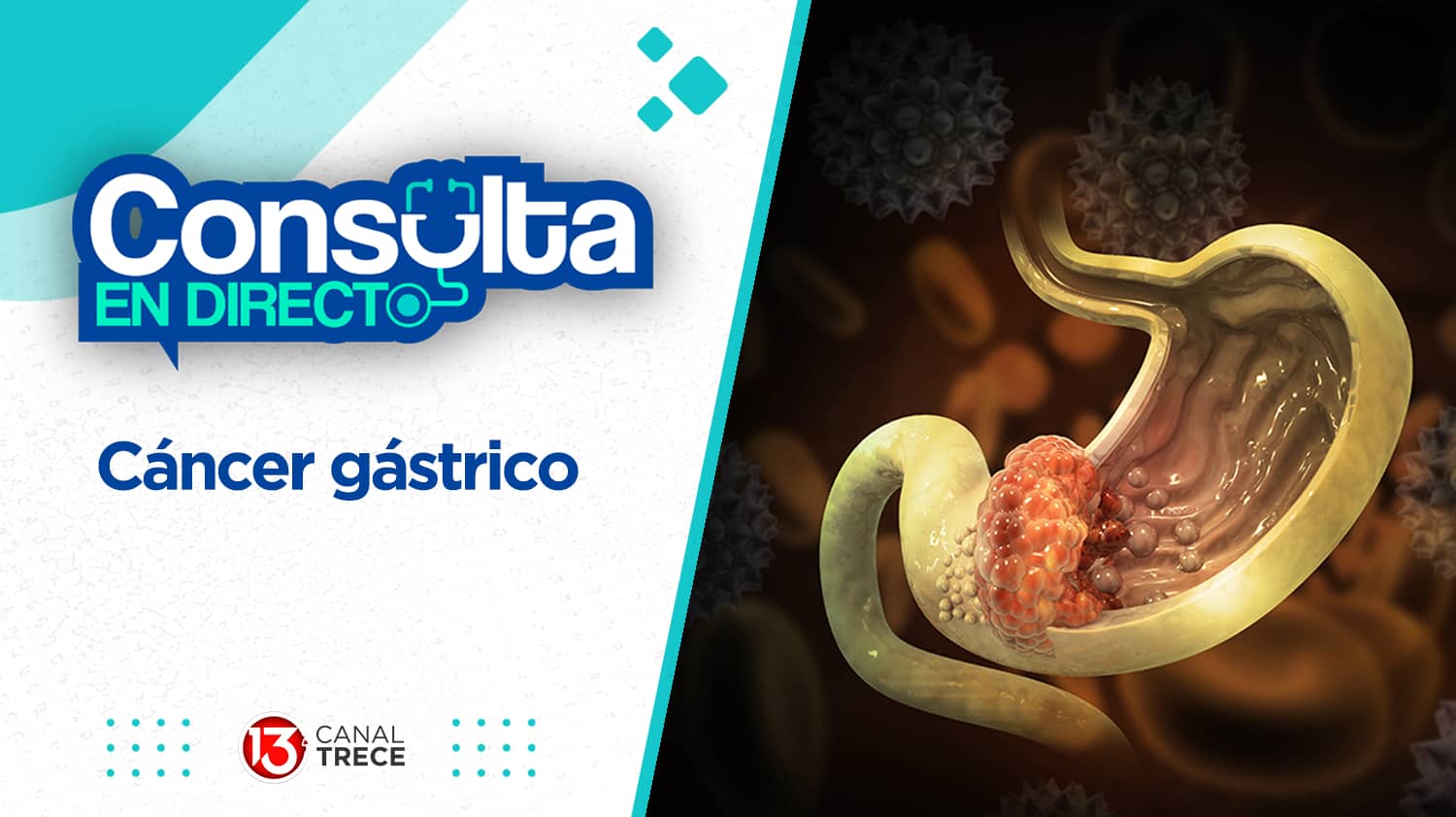 Cáncer gástrico | Consulta en directo 26 marzo 2024. Programa Completo. 