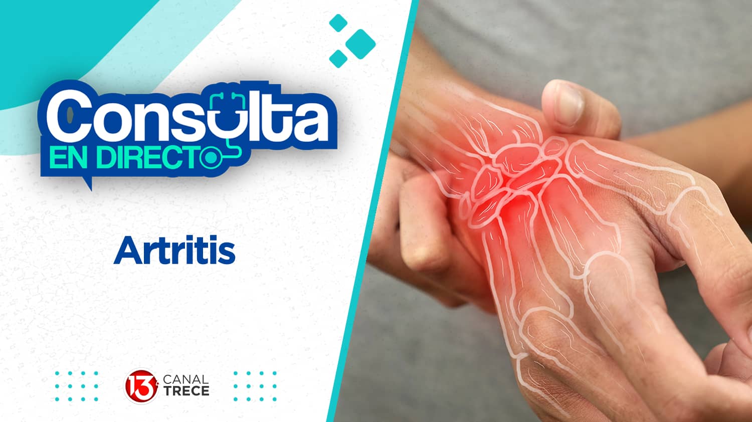 Artritis | Consulta en directo 2 abril 2024. Programa Completo.