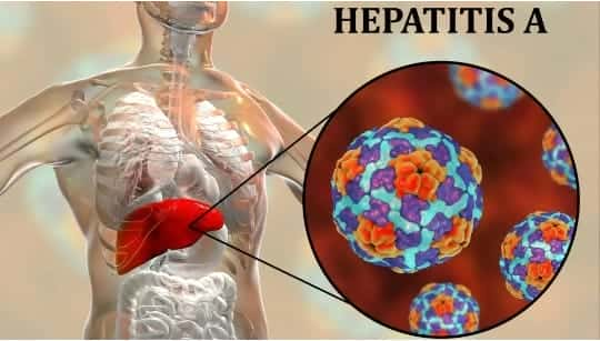 Casos de hepatitis aumentaron 212% en primer semestre de 2023