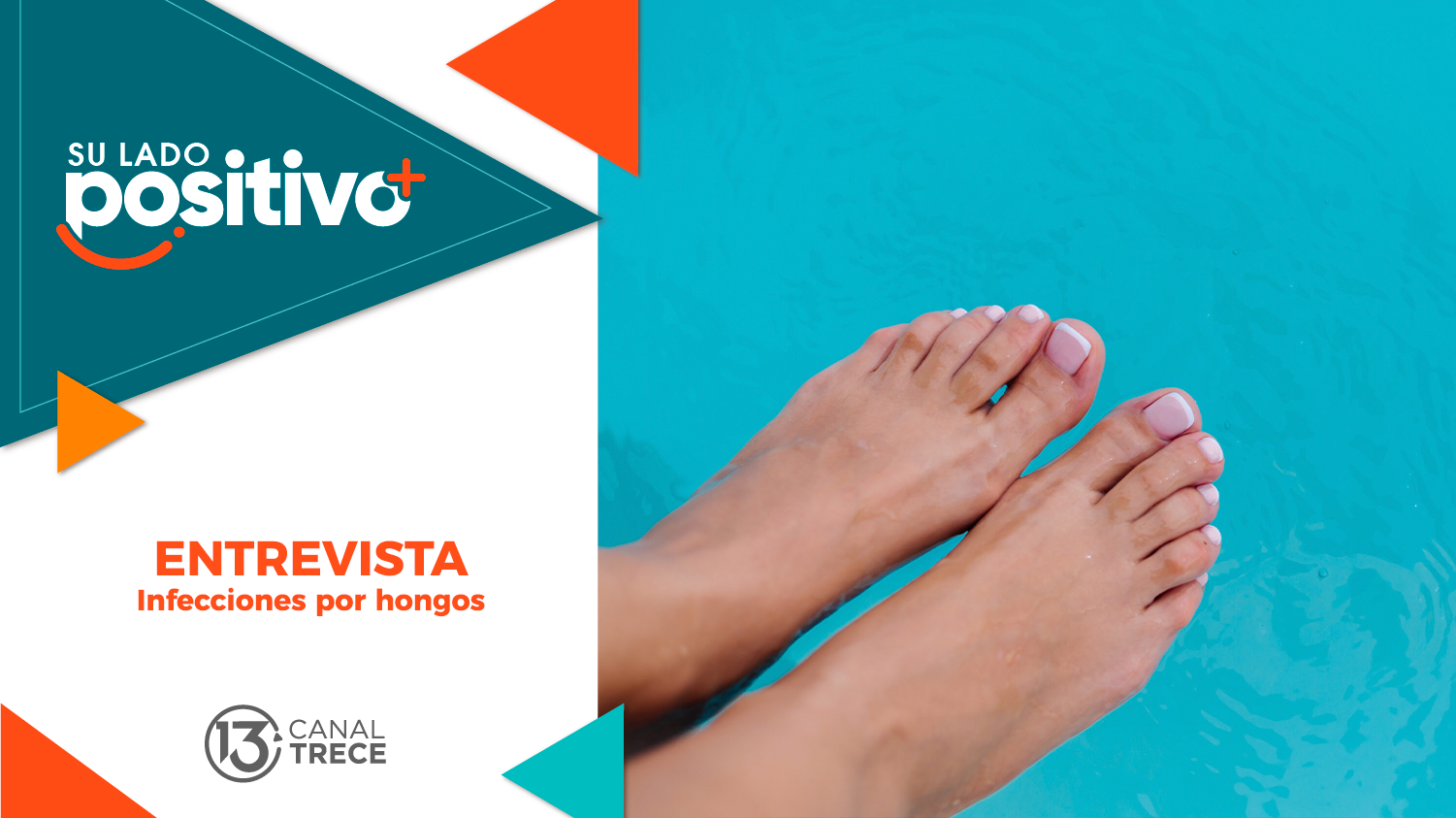 Entrevista Infecciones por Hongos | Su lado Positivo