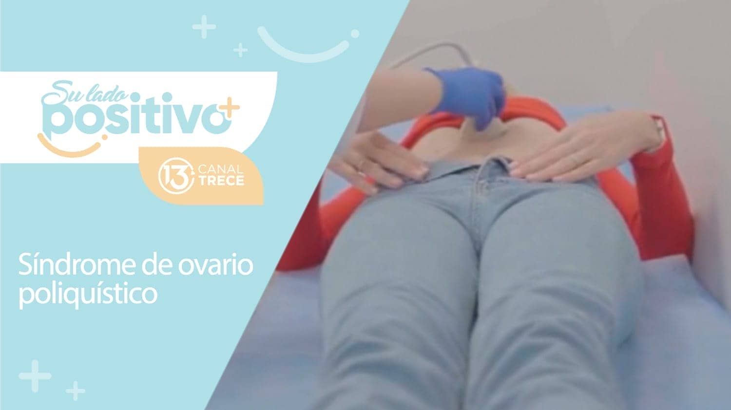 Síndrome de ovario poliquístico | 14 de setiembre 2023