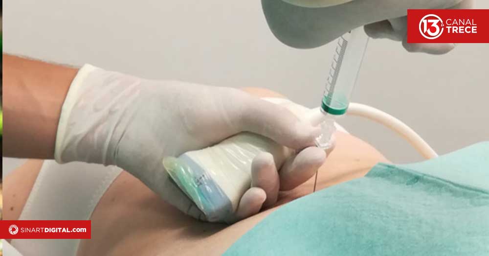 Ozonoterapia: una opción para mejorar su calidad de vida 