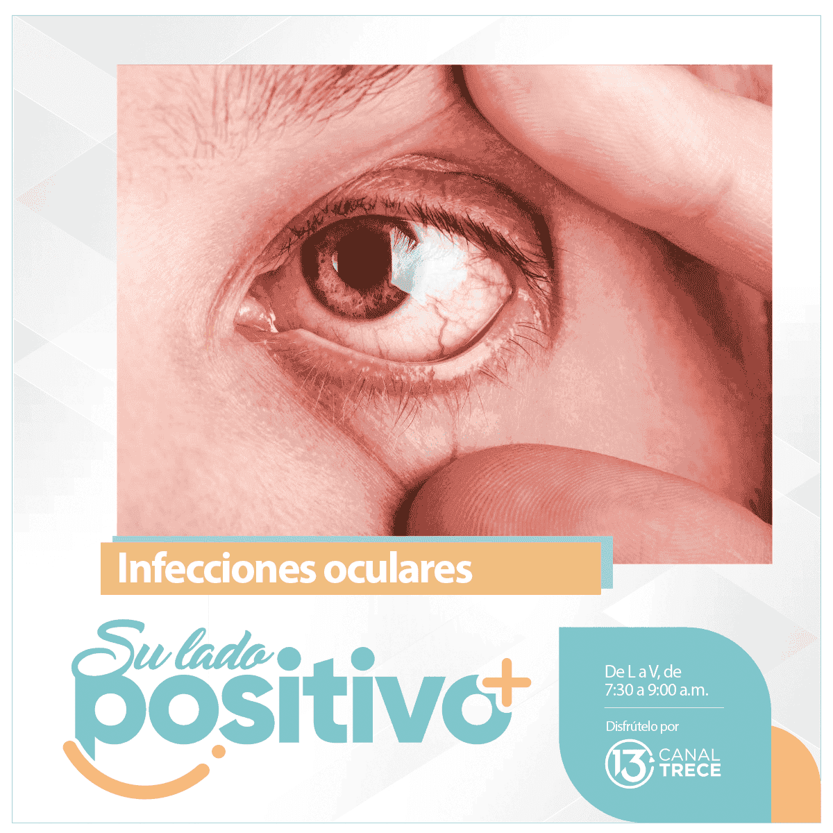 Infecciones oculares