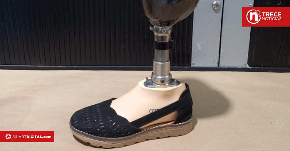 CCSS simplifica entrega de prótesis de miembro inferior con nueva reforma al reglamento