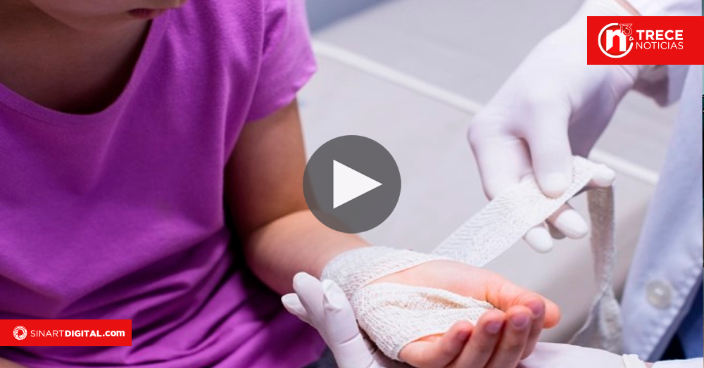 Especialistas alertan aumento de quemaduras infantiles durante fin e inicio de año